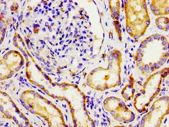 Polyclonal Rabbit anti-Human NPR3 Antibody (IHC)