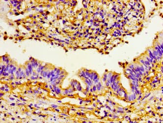 Polyclonal Rabbit anti-Human PRTN3 / Myeloblastin Antibody (IHC)