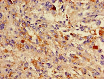 Polyclonal Rabbit anti-Human DCT / Dopachrome Tautomerase Antibody (IHC)