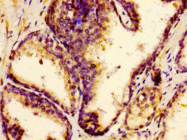 Polyclonal Rabbit anti-Human F12 / Factor XII Antibody (IHC)