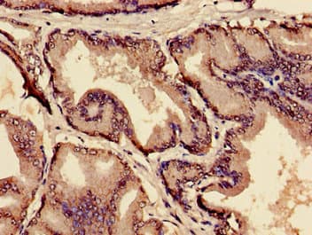 Polyclonal Rabbit anti-Human MIA / CD-RAP Antibody (IHC)