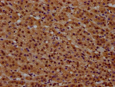 Polyclonal Rabbit anti-Human HIST1H1E Antibody (IHC)
