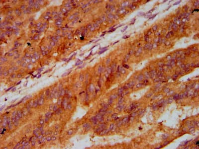 LECT2 Antibody