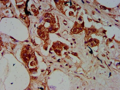 SSR2 Antibody