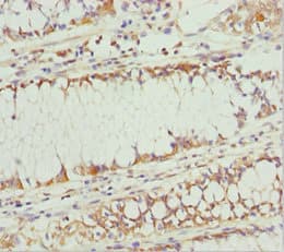 PLEKHA1 Antibody