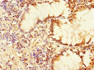 PLK3 Antibody