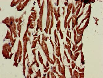 PHOSPHO1 Antibody