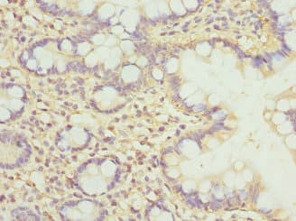 CLASP1 Antibody
