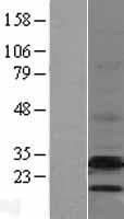 EBP Protein (Over-Expression Lysate Myc-DDK (Flag))