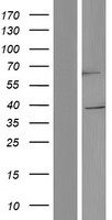 TRIM5 Protein (Over-Expression Lysate Myc-DDK (Flag))