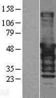 DNAJA2 Protein (Over-Expression Lysate Myc-DDK (Flag))