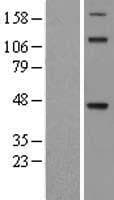 TDO2 Protein (Over-Expression Lysate Myc-DDK (Flag))