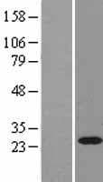 RAB11A Protein (Over-Expression Lysate Myc-DDK (Flag))