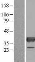 APOE / Apolipoprotein E (Over-Expression Lysate Myc-DDK (Flag))