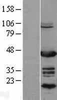 EAR2 / NR2F6 Protein (Over-Expression Lysate Myc-DDK (Flag))
