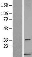 S100P Protein (Over-Expression Lysate Myc-DDK (Flag))