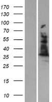 ALAD Protein (Over-Expression Lysate Myc-DDK (Flag))