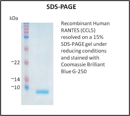 Human CCL5 / RANTES Protein (Recombinant)
