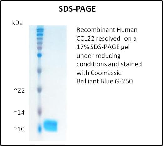 Human CCL22 / MDC Protein (Recombinant)