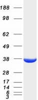 Human AKR1A1 Protein (Recombinant Myc-DDK (Flag))