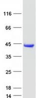 Human AKR1A1 Protein (Recombinant Myc-DDK (Flag))