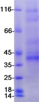 Human CD33 Protein (Recombinant Myc-DDK (Flag))