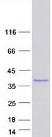 Human CNN2 Protein (Recombinant Myc-DDK (Flag))