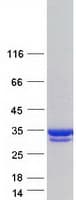 Human COMT Protein (Recombinant Myc-DDK (Flag))