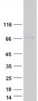Human CPT2 Protein (Recombinant Myc-DDK (Flag))