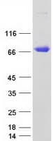Human CSF1 / MCSF Protein (Recombinant Myc-DDK (Flag))