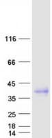 Human CSF1 / MCSF Protein (Recombinant Myc-DDK (Flag))