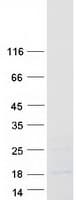 Human CSF3 / G-CSF Protein (Recombinant Myc-DDK (Flag))