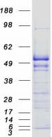 Human EF1G / EEF1G Protein (Recombinant Myc-DDK (Flag))