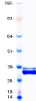 Human IGFBP4 Protein (Recombinant Myc-DDK (Flag))