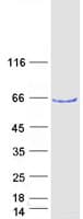 Human LIMK2 Protein (Recombinant Myc-DDK (Flag))