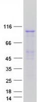 Human MSH2 Protein (Recombinant Myc-DDK (Flag))