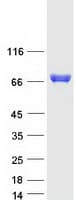 Human MTHFR Protein (Recombinant Myc-DDK (Flag))