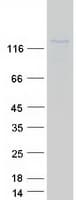 Human NOS2 / iNOS Protein (Recombinant Myc-DDK (Flag))