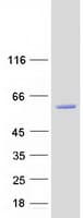 Human NOVA1 Protein (Recombinant Myc-DDK (Flag))