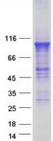 Human PDE4B Protein (Recombinant Myc-DDK (Flag))