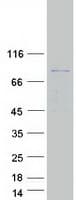 Human PYGM Protein (Recombinant Myc-DDK (Flag))