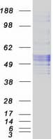 Human Antithrombin-III Protein (Recombinant Myc-DDK (Flag))