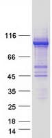 Human E6AP / UBE3A Protein (Recombinant Myc-DDK (Flag))