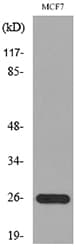 Polyclonal Rabbit anti-Human LGALS3 / Galectin 3 Antibody (WB)
