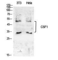 Polyclonal Rabbit anti-Human CSF1 / MCSF Antibody (WB)