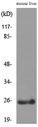 Polyclonal Rabbit anti-Human CRP / C-Reactive Protein Antibody (WB)