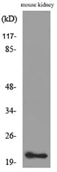 Polyclonal Rabbit anti-Human ADM / Adrenomedullin Antibody (WB)