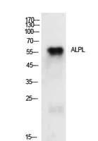 Polyclonal Rabbit anti-Human ALPL / Alkaline Phosphatase Antibody (WB)