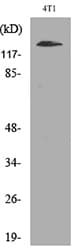 Polyclonal Rabbit anti-Human ITGAD / CD11d Antibody (WB)