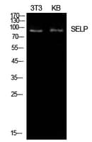Polyclonal Rabbit anti-Human SELP / P-Selectin / CD62P Antibody (WB)